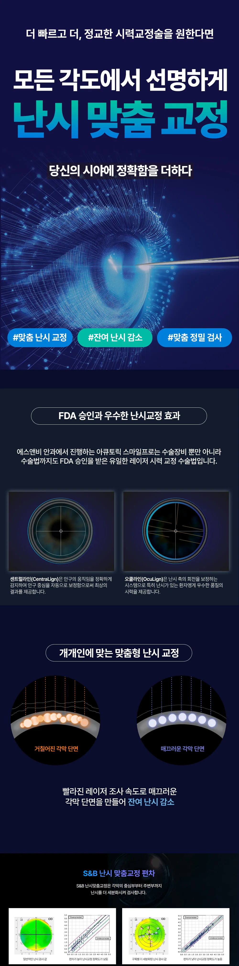 난시 맞춤 교정과 잔여 난시 감소를 설명하는 S&B안과 안내 이미지