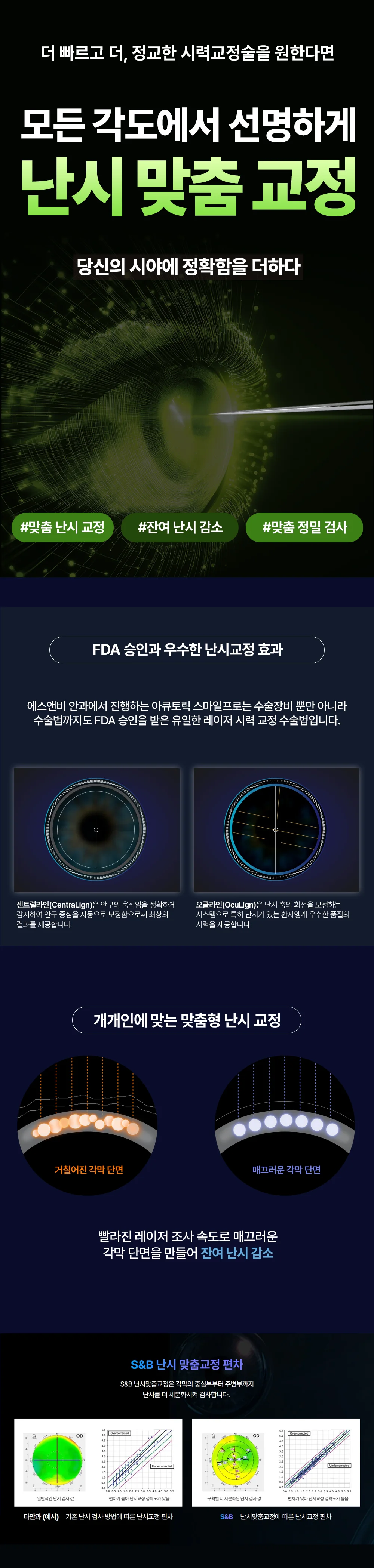 S&B안과 백내장 수술 안내 이미지 첫 번째