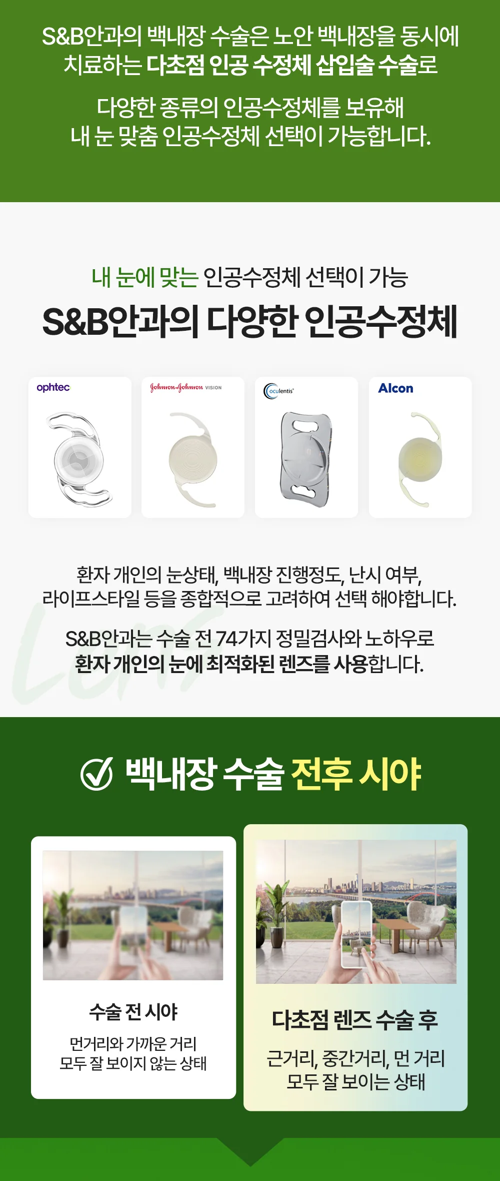 S&B안과 백내장 수술 안내 이미지 네 번째