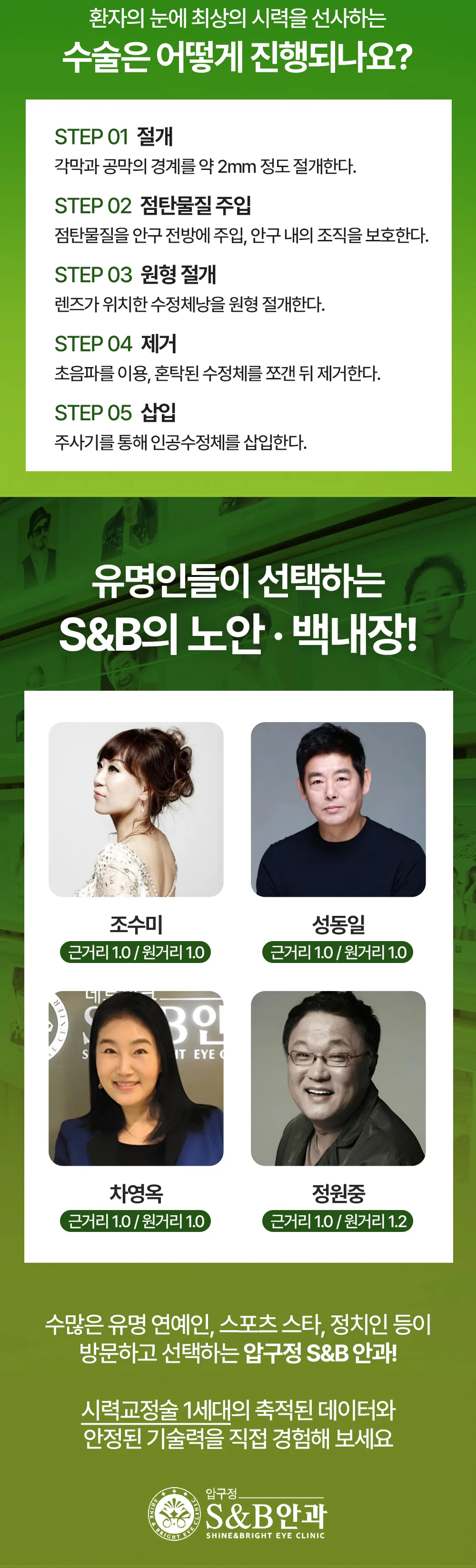 S&B안과 백내장 수술 안내 이미지 다섯 번째