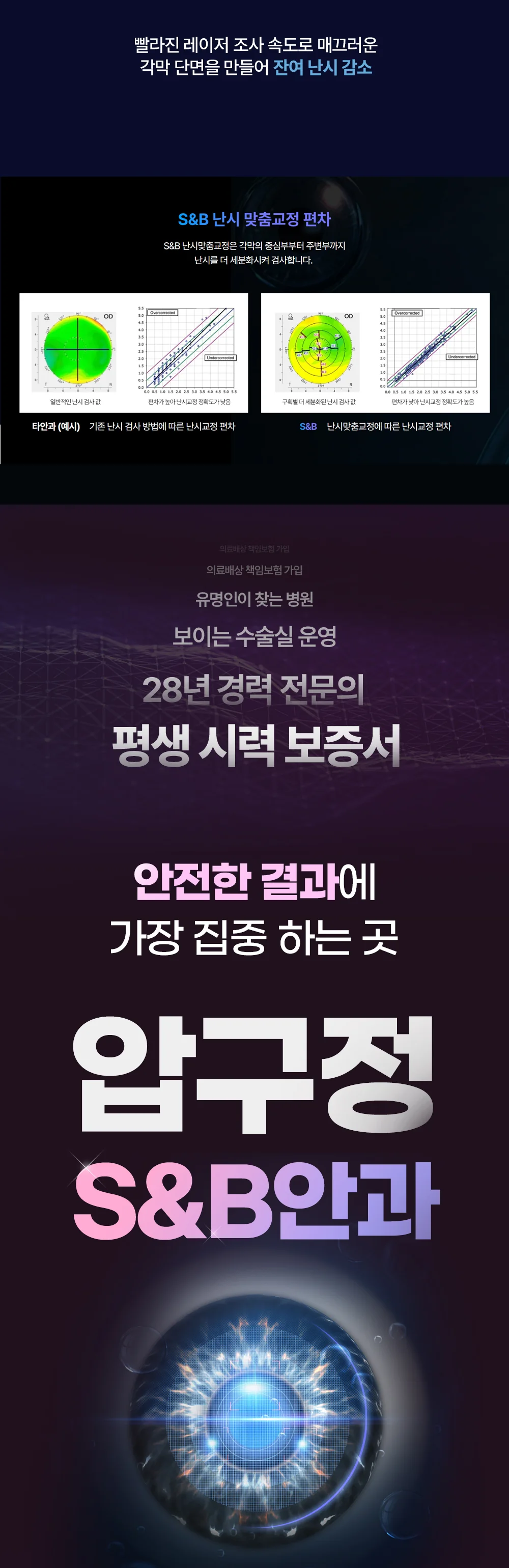 S&B안과 맞춤 난시 교정 시스템을 소개하는 이미지