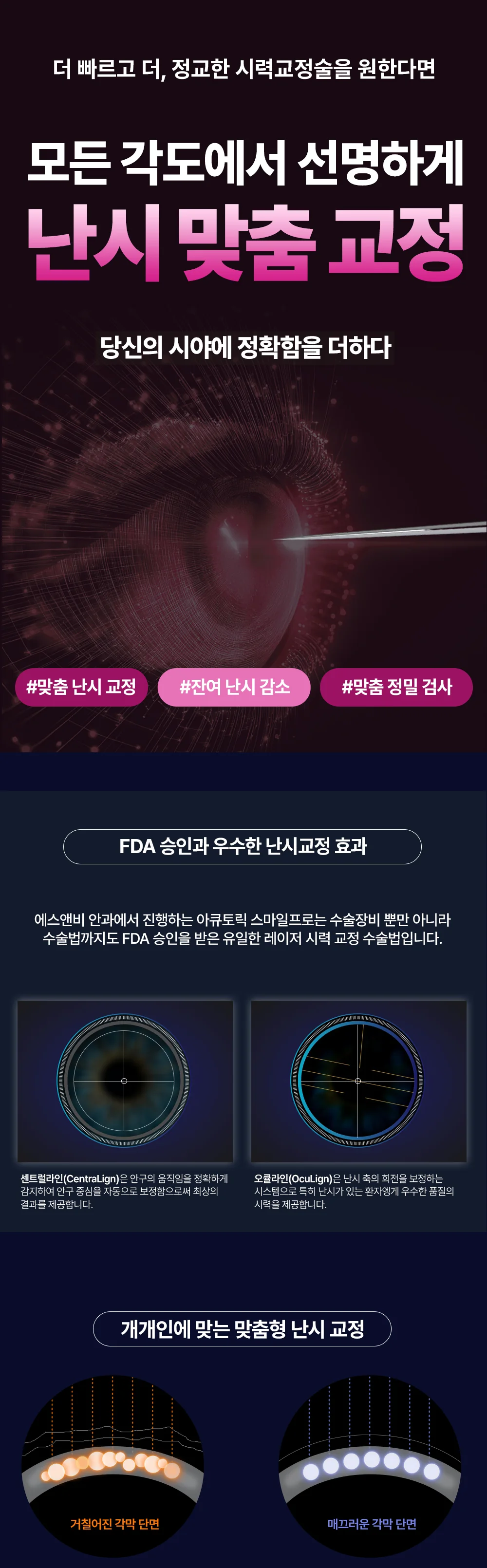 렌즈삽입술과 난시 맞춤 교정을 안내하는 S&B안과 홍보 이미지