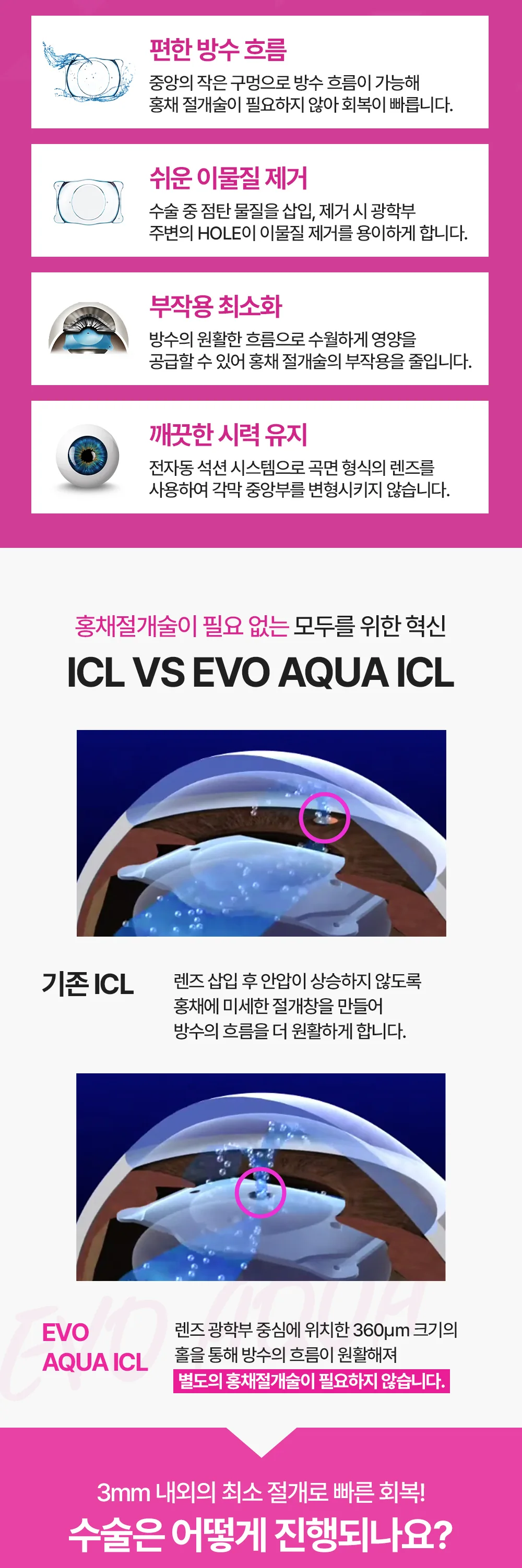 EVO AQUA ICL 렌즈삽입술의 검사와 장점을 안내하는 이미지