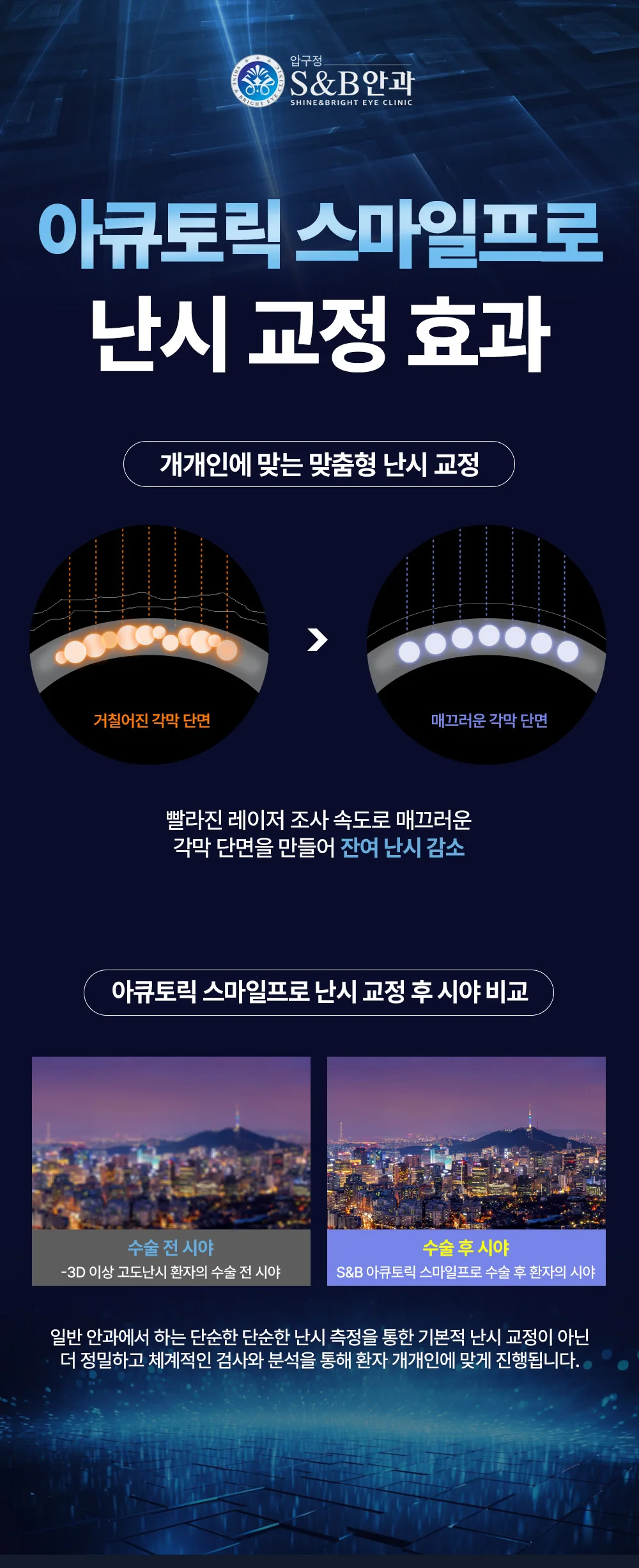 스마일프로 맞춤형 난시 교정 원리와 수술 전후 시야를 안내하는 이미지