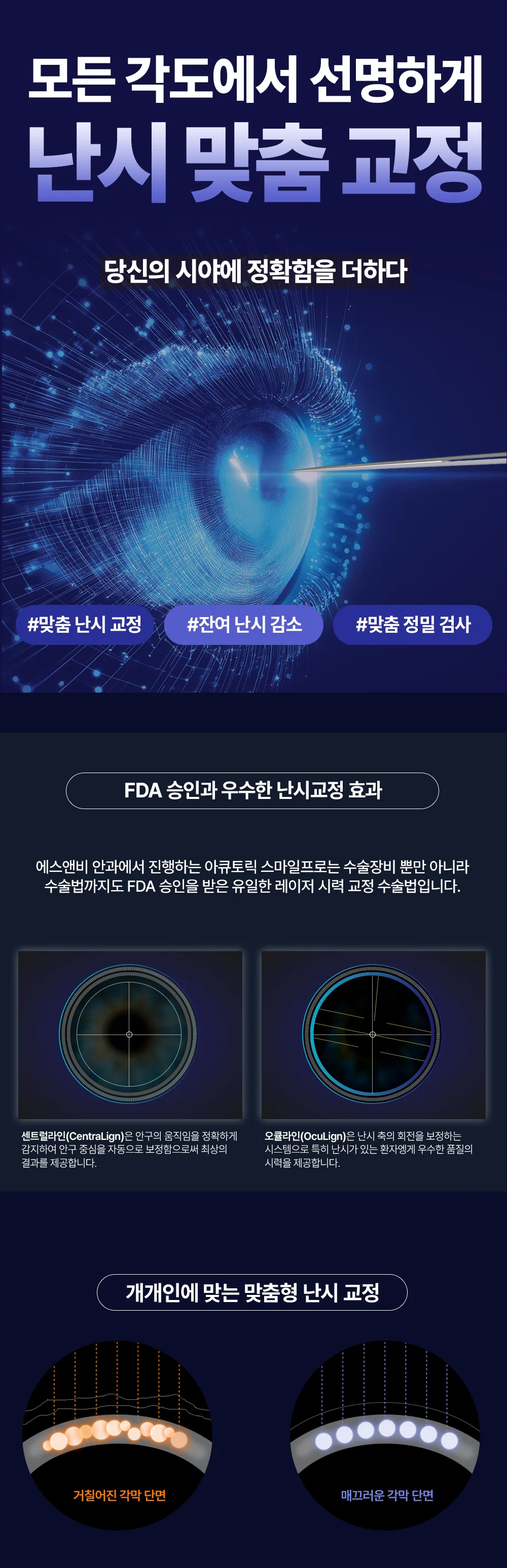 투데이라섹의 맞춤 난시 교정과 잔여 난시 감소 원리를 안내하는 이미지