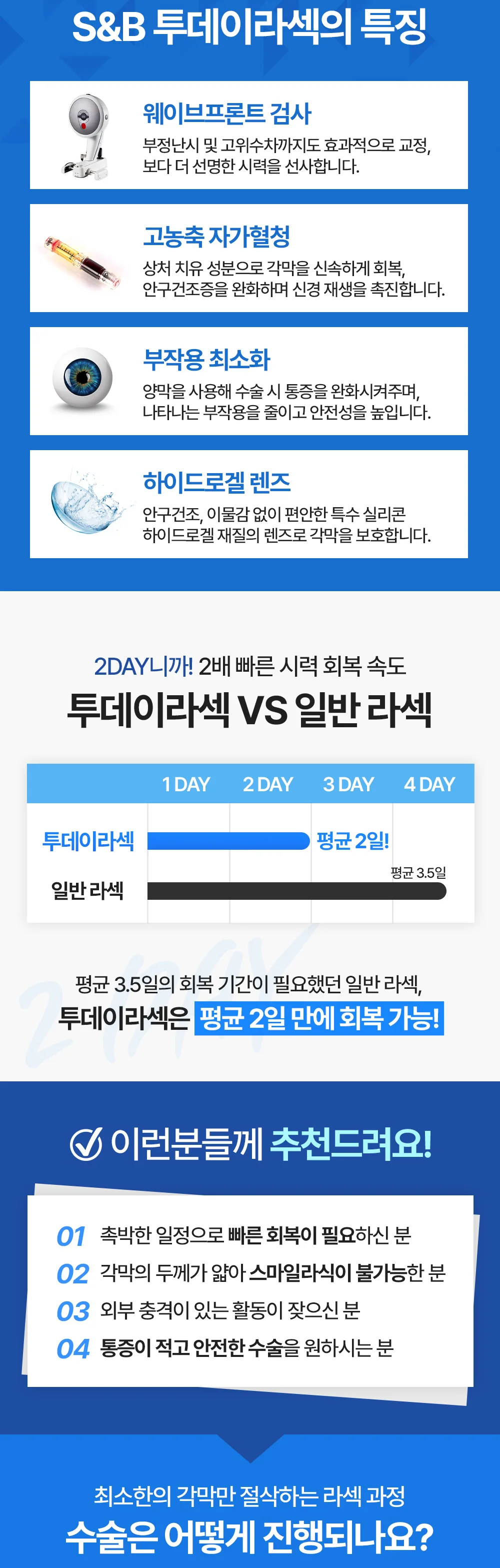투데이라섹의 검사와 회복 특징 및 일반 라섹과의 차이를 안내하는 이미지