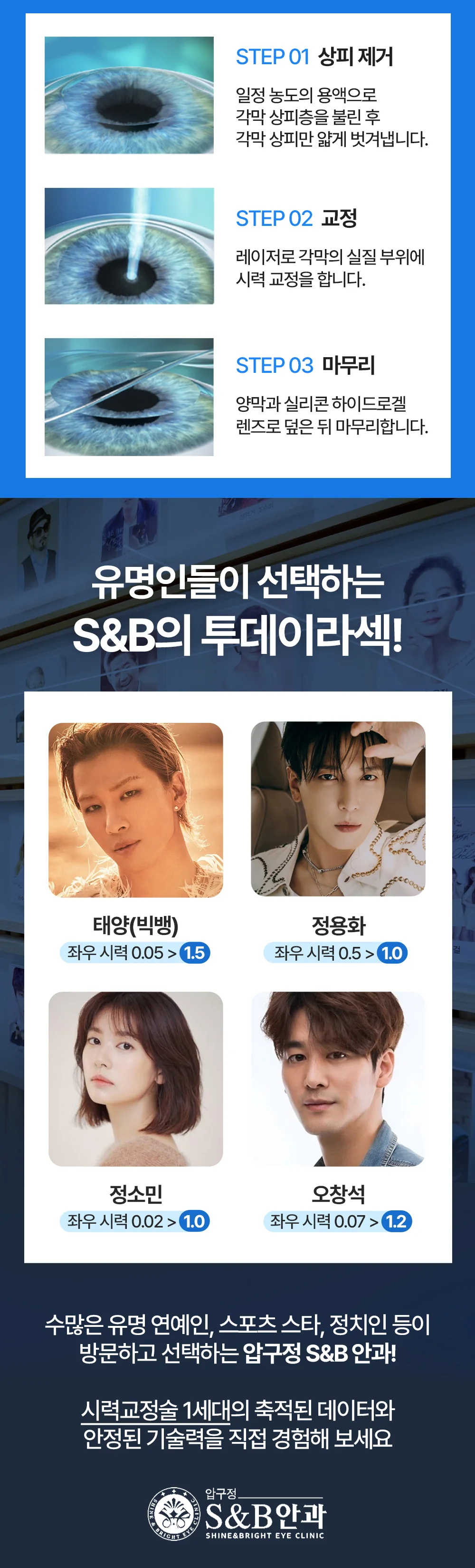 투데이라섹의 수술 과정과 S&B안과 시력교정 진료를 안내하는 이미지